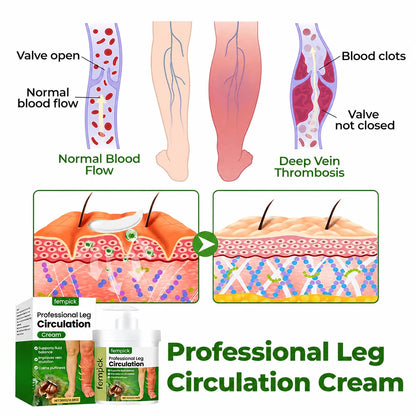 Fempick® Professional Leg Circulation Cream