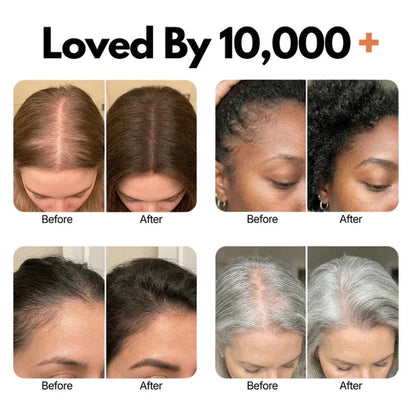 Korean Hair Growth Serum for Thinning Hair & Shedding