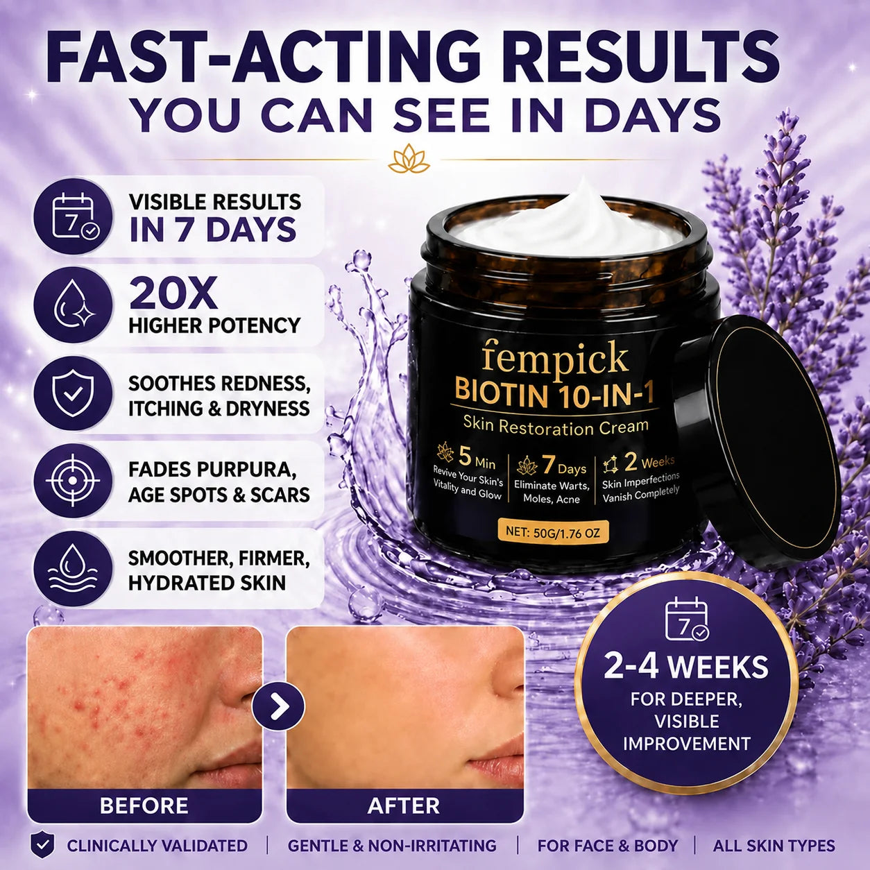✨Up TO 70% OFF 💯 Fempick® Biotin 10-in-1 Skin Restoration Cream
