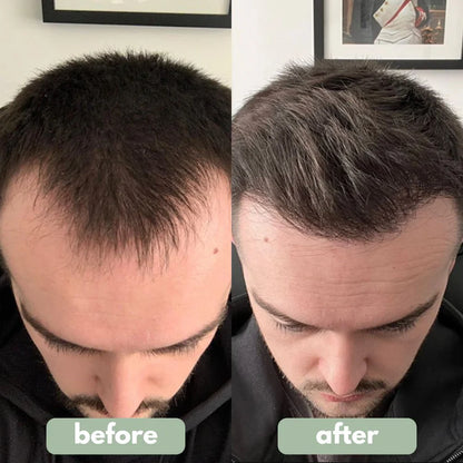 Fempick - Hair Growth Serum
