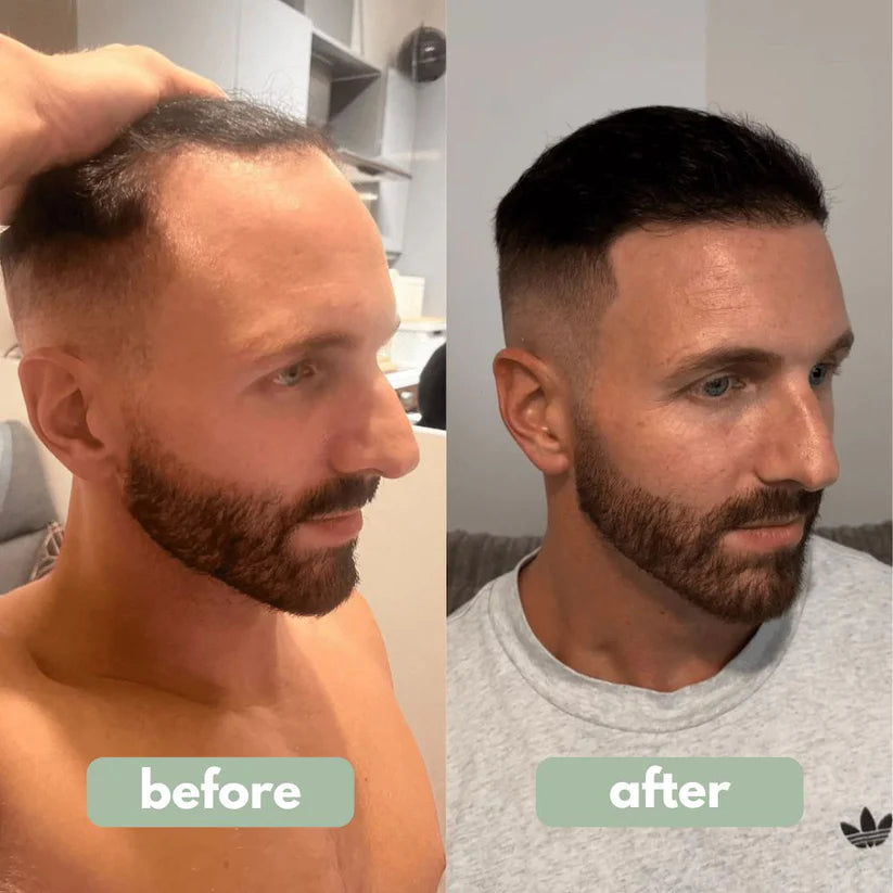 Fempick - Hair Growth Serum